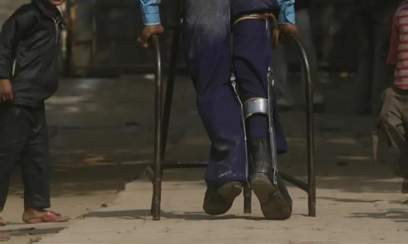 پاکستان از ثبت پنجمین مورد فلج اطفال در سال جاری میلادی در یک دختربچه ۱۷ ماهه در منطقه «بنو» (ایالت خیبر پختونخواه) خبر داد.